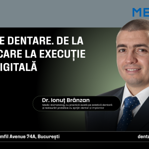 Fațetele dentare. De la planificare la execuție în era digitală