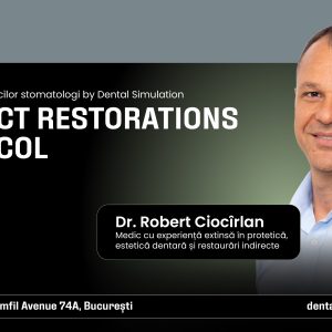 Indirect Restorations Protocol