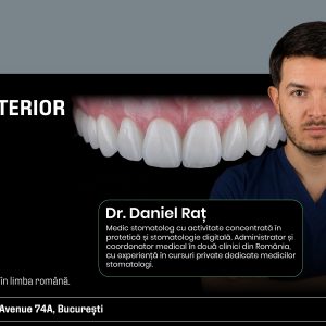 Fațete anterior