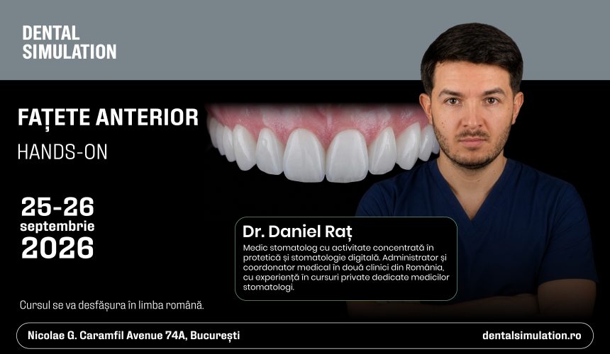 Fațete anterior